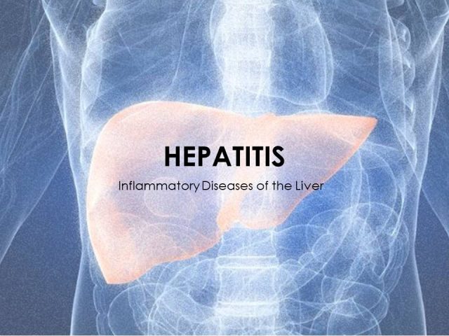 Hepatitis A, B, C, D, E and Alcoholic Hepatitis: Causes, Treatment and Prevention